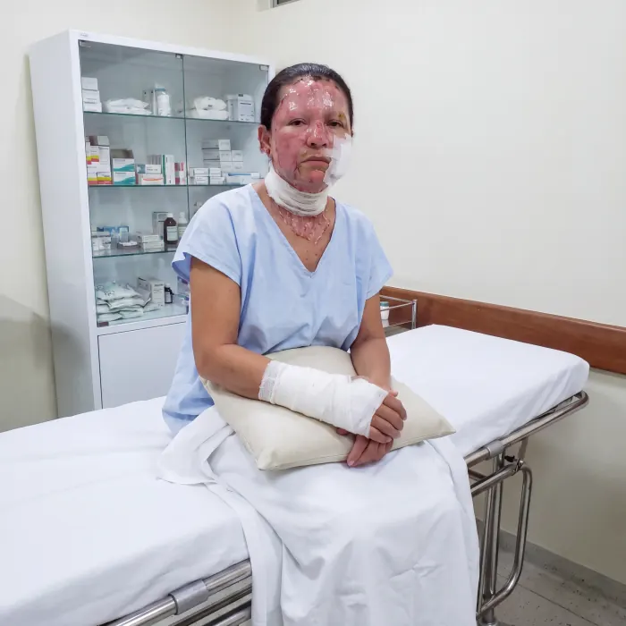 Ivone sentada na maca de um consultório, com a mão direita enfaixada apoiada sobre um travesseiro